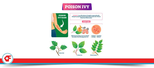 Poison Ivy Treatment Clinic Near Me in Davie FL