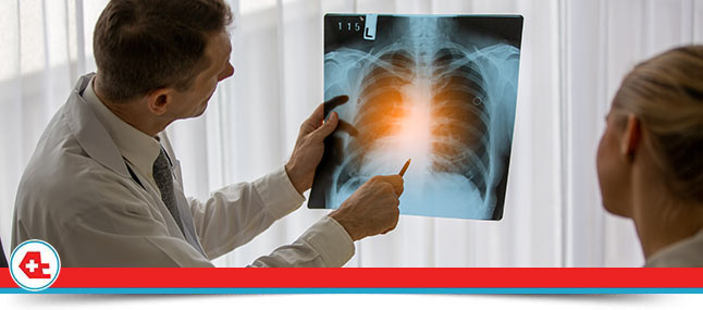 When Do You Need an X-Ray Near Me in Davie, FL When Do You Need an X-Ray Near Me in Davie, FL