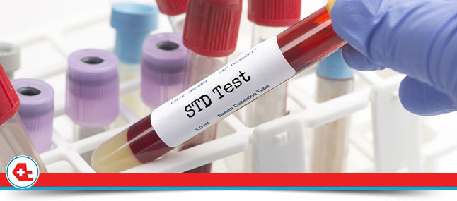How Much Does STD Testing Cost Near Me in Davie, FL?