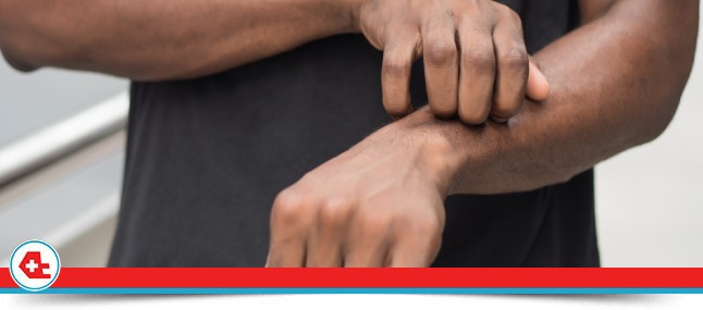 Urgent Care for Ringworm Treatment Near Me in Davie FL Urgent Care for Ringworm Treatment Near Me in Davie FL