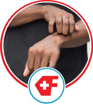 Ringworm Treatment Near Me in Davie, FL